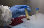China CDC helps Sierra Leone establish molecular test method for COVID-19