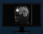 Well-known AI medical imaging company completes B-round financing, speeding up layouts in China and global market